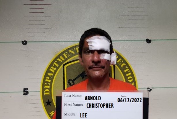 Man accused of beating victim with a bat, cut with machete arrested ...